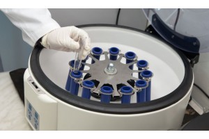 Santrifüj Cihazı Nedir? Ne İşe Yarar ve Santrifüj Cihazı Fiyatları